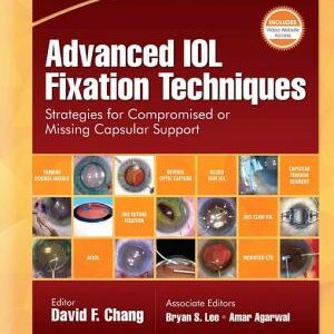 Advanced IOL Fixation Techniques: Strategies for Compromised or Missing Capsular Support