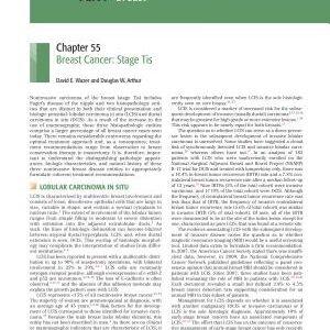 Perez & Brady's Principles and Practice of Radiation Oncology