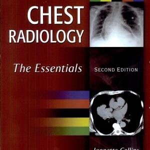 Chest Radiology: The Essentials