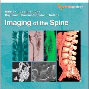 Imaging of the Spine E-Book: Expert Radiology Series