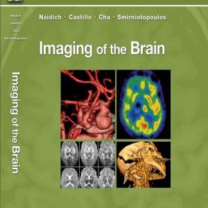 Imaging of the Brain E-Book: Expert Radiology Series