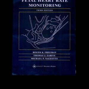Fetal Heart Rate Monitoring